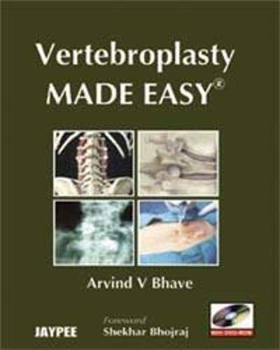 Vertebroplasty Made Easy 1Edition