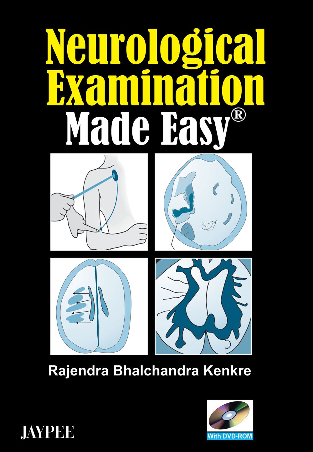 Neurological Examination Made Easy With Dvd Rom1 Edition