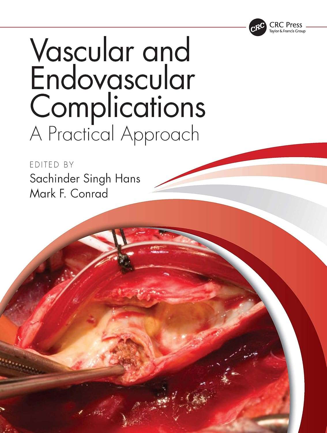 Vascular And Endovascular Complications A Practical Approach (Hb)