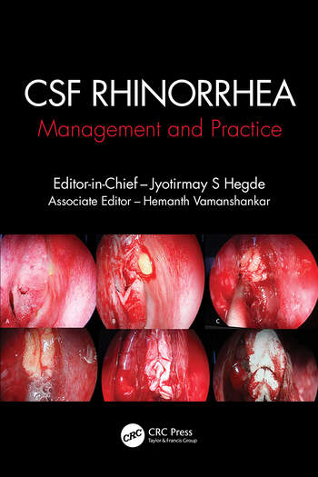 CSF Rhinorrhoea Management and Practice 1 Edition