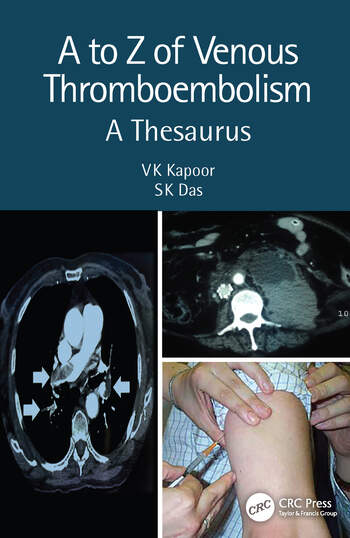 A to Z of Venous Thromboembolism A Thesaurus 2 Edition