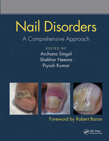 Nail Disorders A Comprehensive Approach 1 Edition