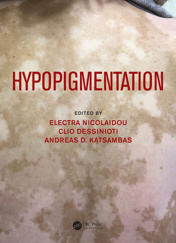 Hypopigmentation 1 Edition