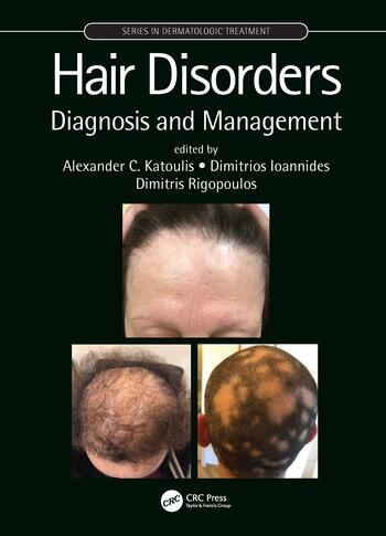 Hair Disorders Diagnosis and Management 1 Edition