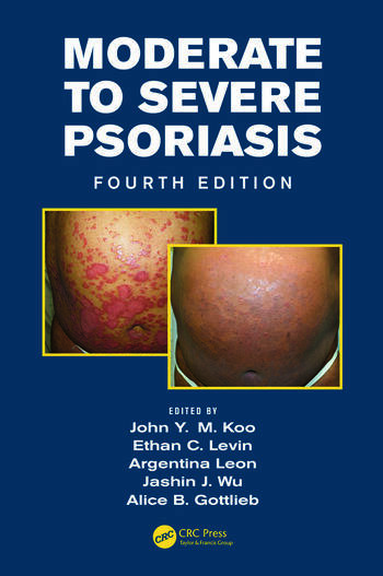 Moderate to Severe Psoriasis 4 Edition