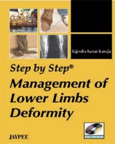 Step by Step Management of Lower Limbs Deformity