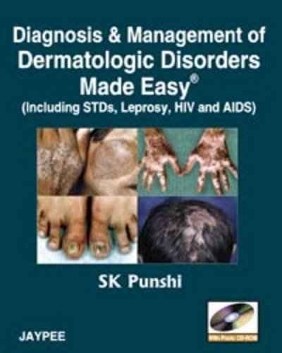 Diagnosis & Management Of Dermatologic Disorders Made Easy