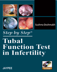 Step by Step Tubal Function Test in Infertility with CD ROM