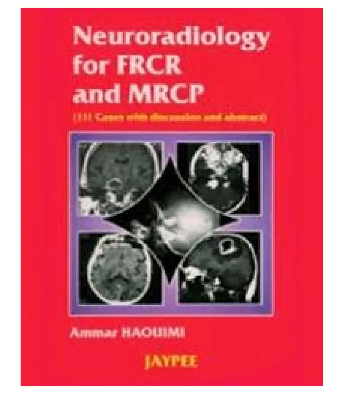 Neuroradiology for FRCR and MRCP