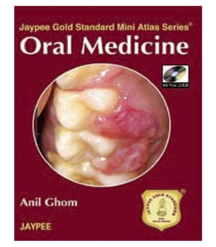 Oral Medicine With Photo Cd-Rom Jaypee Gold Standard Mini Atlas Series