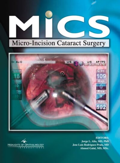 Mics Micro-Incision Cataract Surgery 1 Edition (HP)