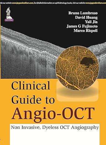 Clinical Guide To Angio-Oct: Non Invasive,Dyeless Oct Angiography,1 Edition