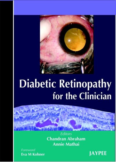 Diabetic Retinopathy For The Clinician 1 Edition
