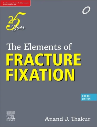 The Elements Of Fracture Fixation