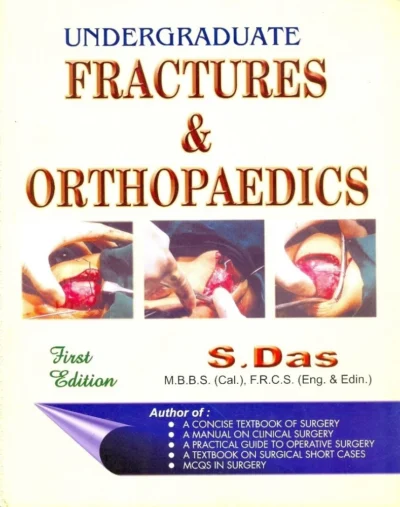 Undergraduate Fractures & Orthopaedics,1 Edition