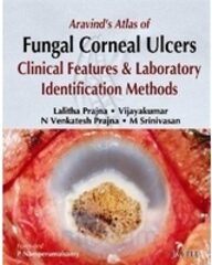 Aravind'S Atlas Of Fungal Corneal Ulcers Clinical Features & Lab.Identification Methods,1 Edition