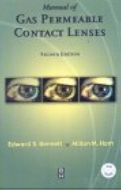 Manual Of Gas Permeable Contact Lenses 2 Edition