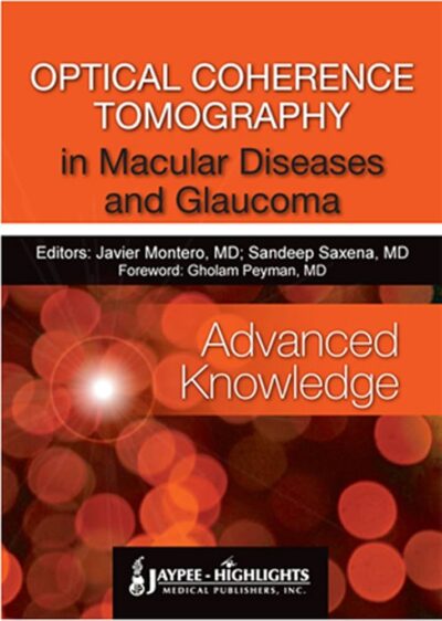 Optical Coherence Tomography In Macular Diseases And Glaucoma(Advanced Knowledge),1 Edition