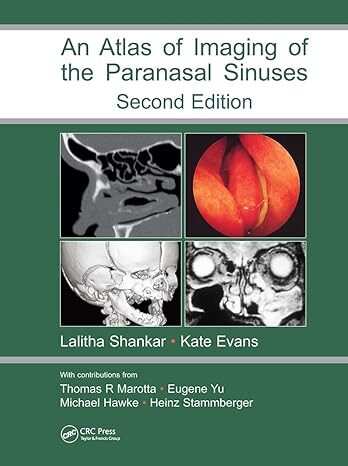An Atlas Of Imaging Of The Paranasal Sinuses 2 Edition (HB)