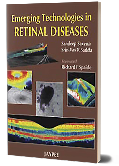 Emerging Technologies In Retinal Diseases 1 Edition
