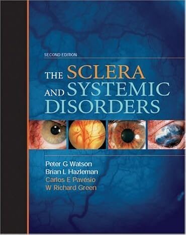 Sclera And Systemic Disorders 2 Edition