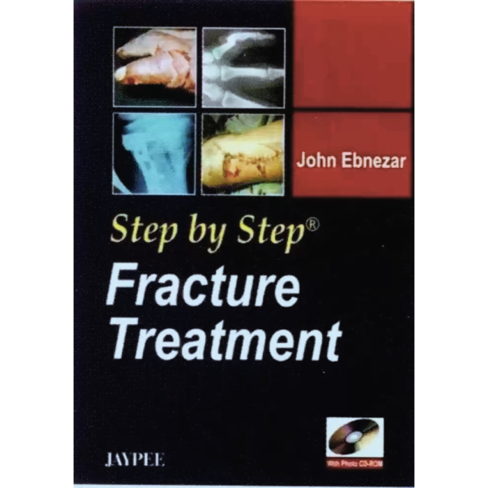 FRACTURE TREATMENT