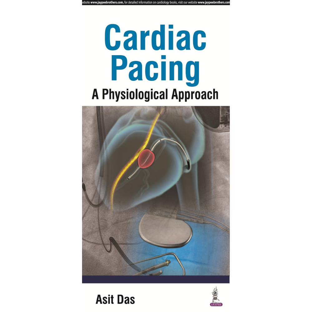 CARDIAC PACING