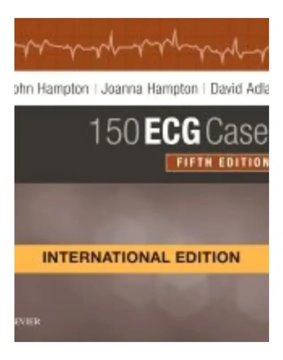 150 ECG Cases International Edition