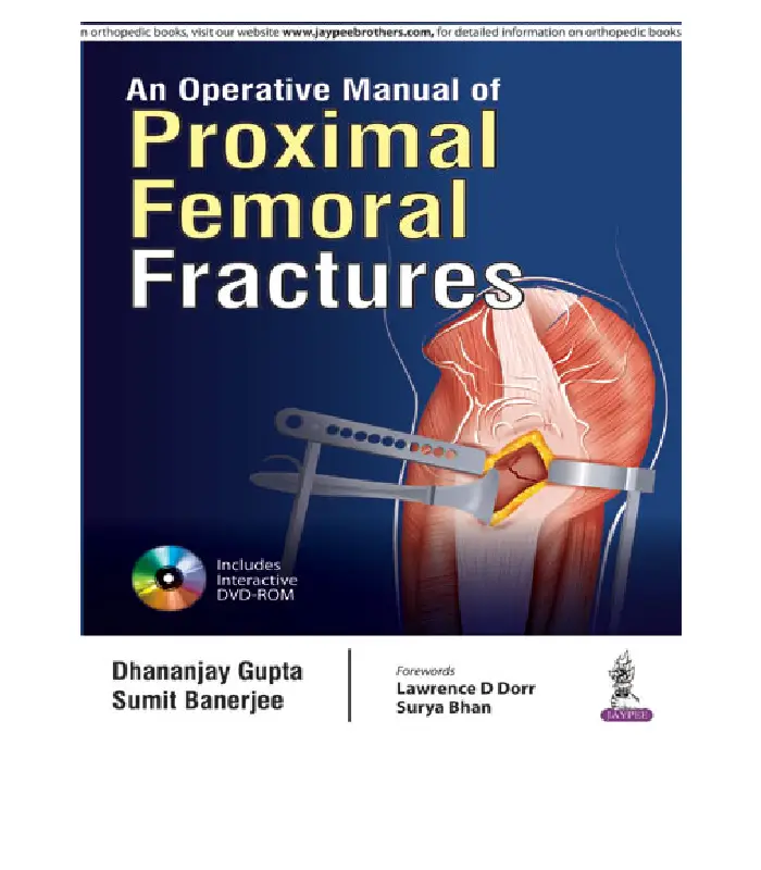 An Operative Manual Of Proximal Femoral Fracture