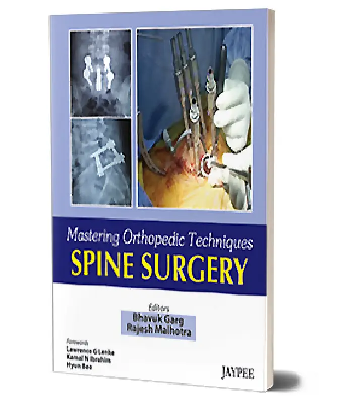 Mastering Orthopedic Techniques Spine Surgery