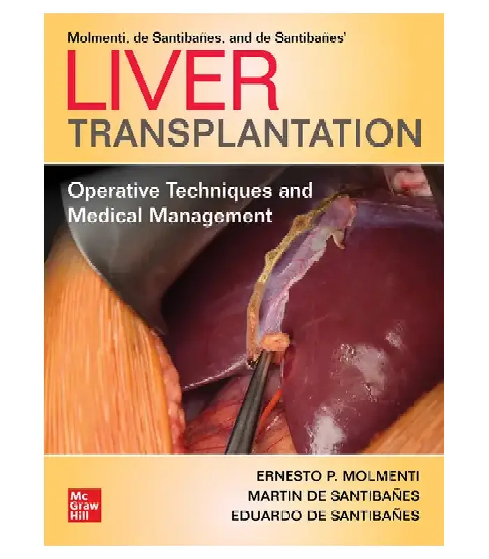 Liver Transplantation Operative Techniques And Medical Management