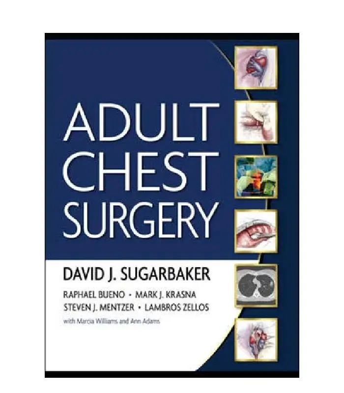 Adult Chest Surgery