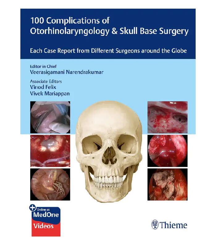 100 Complications of Otorhinolaryngology And Skull Base Surgery