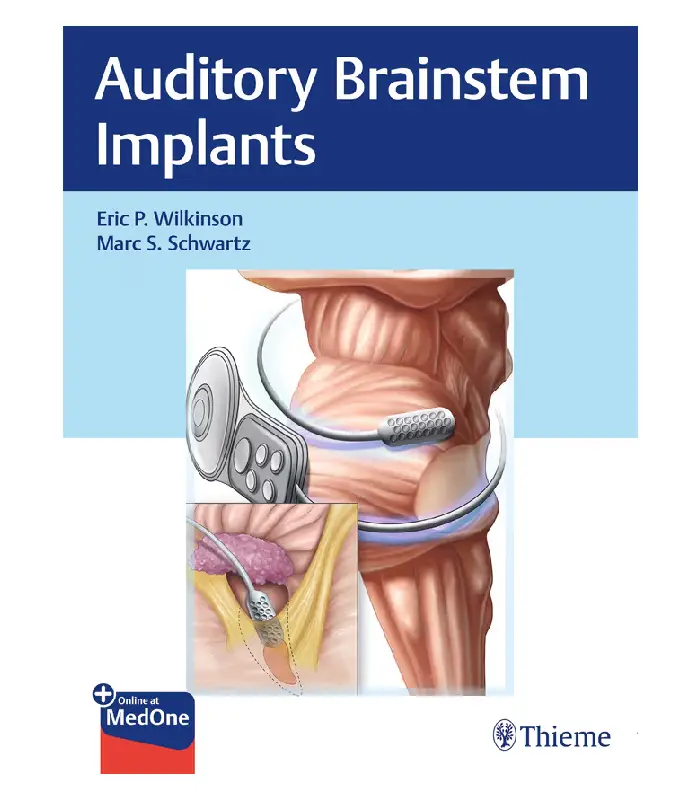 Auditory Brainstem Implants