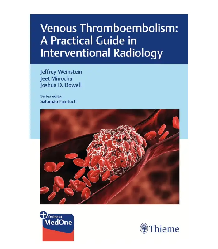 Venous Thromboembolism