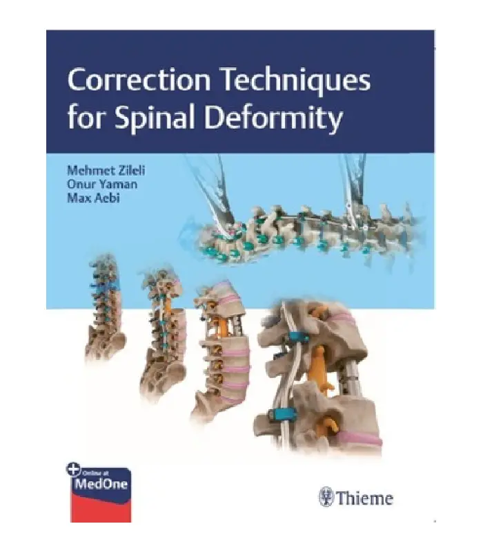 Correction Techniques for Spine Deformity