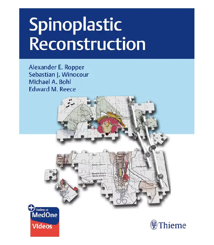 Spinoplastic Reconstruction