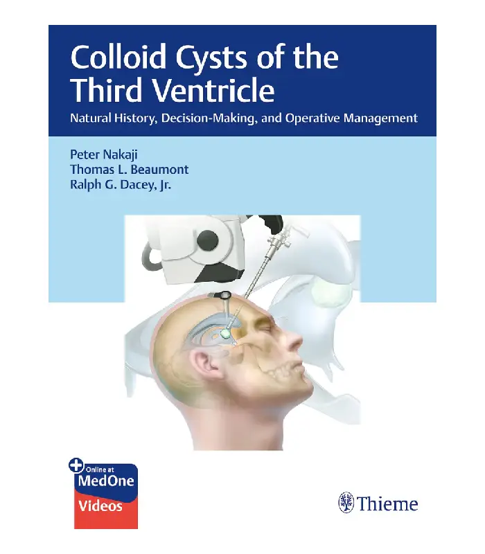 Colloid Cysts of the Third Ventricle