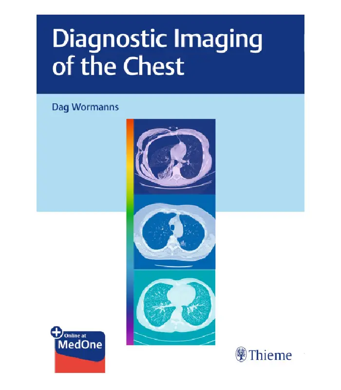 Diagnostic Imaging of the Chest