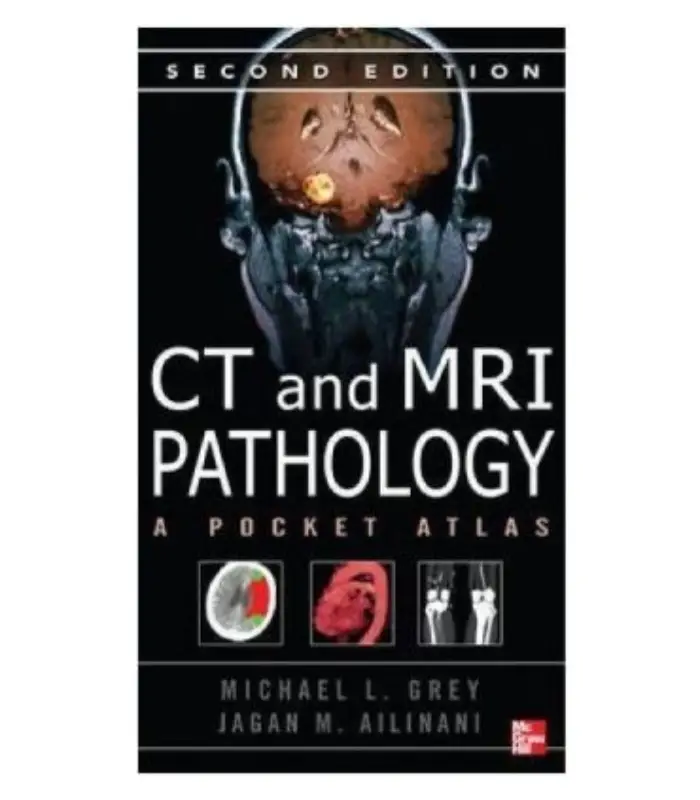 CT & MRI Pathology: A Pocket Atlas