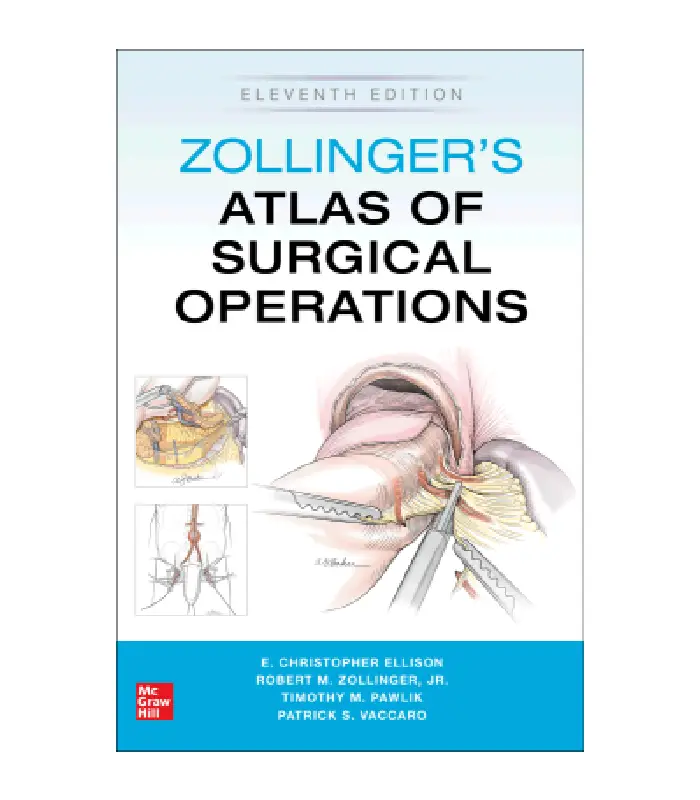 Zollingers Atlas of Surgical Operations