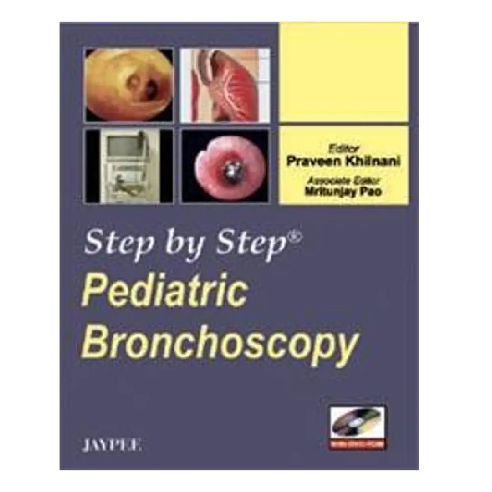 Step by Step PEDIATRIC BRONCHOSCOPY
