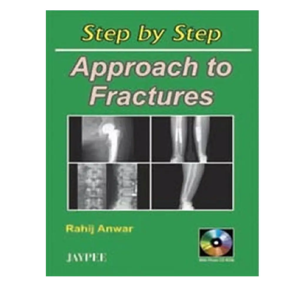 Step BY Step APPROACH TO FRACTURES
