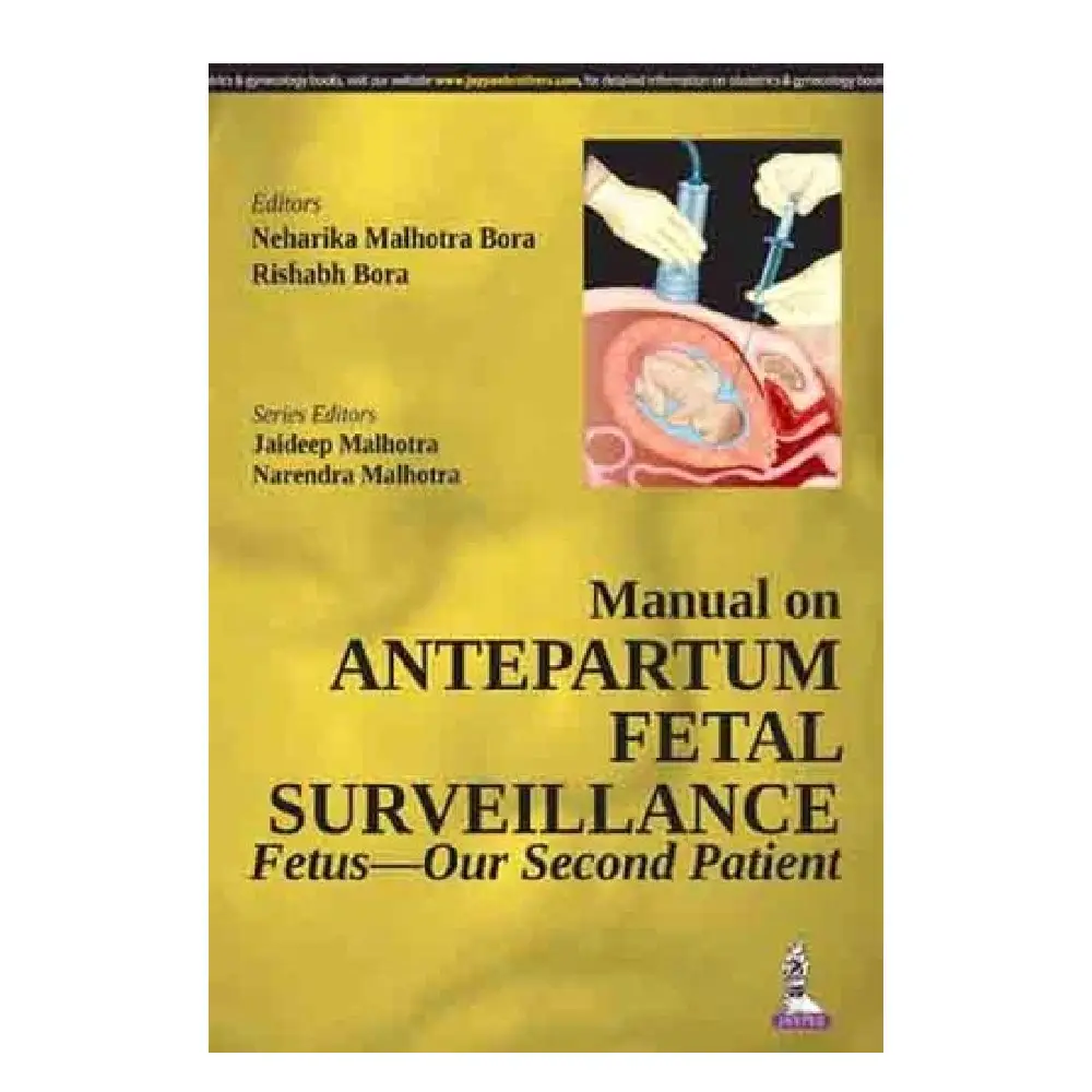 MANUAL ON ANTEPARTUM FETAL SURVEILLANCE Fetus-Our Second Patient