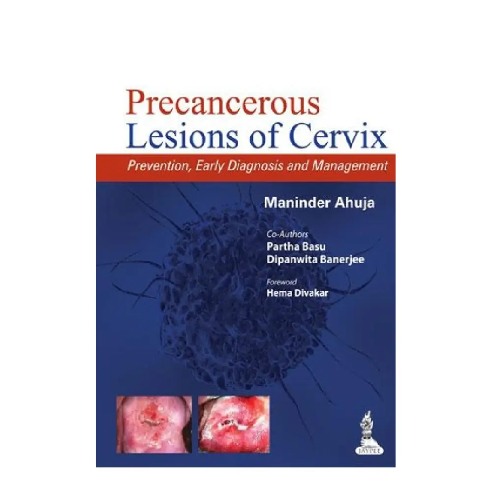 PRECANCEROUS LESIONS OF CERVIX Prevention, Early Diagnosis and Management