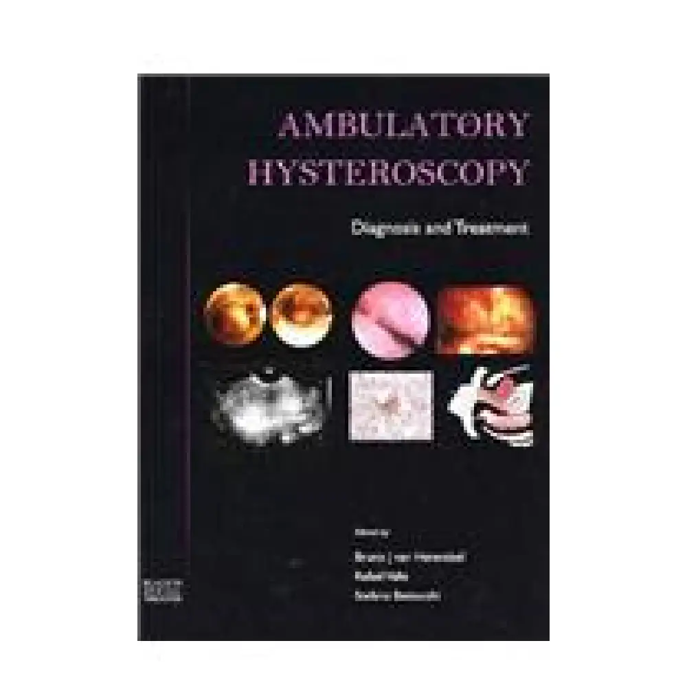 AMBULATORY HYSTEROSCOPY Diagnosis and Treatment