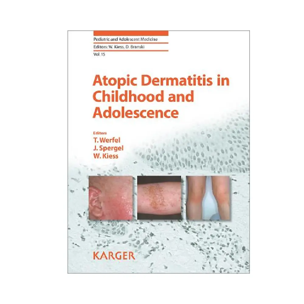 Atopic Dermatitis in Childhood and Adolescence: (Volume-15 Pediatric and Adolescent Medicine)