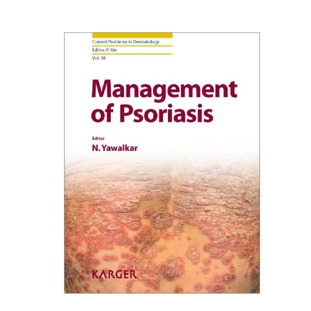 Management of Psoriasis: (Volume-38 Current Problems in Dermatology)