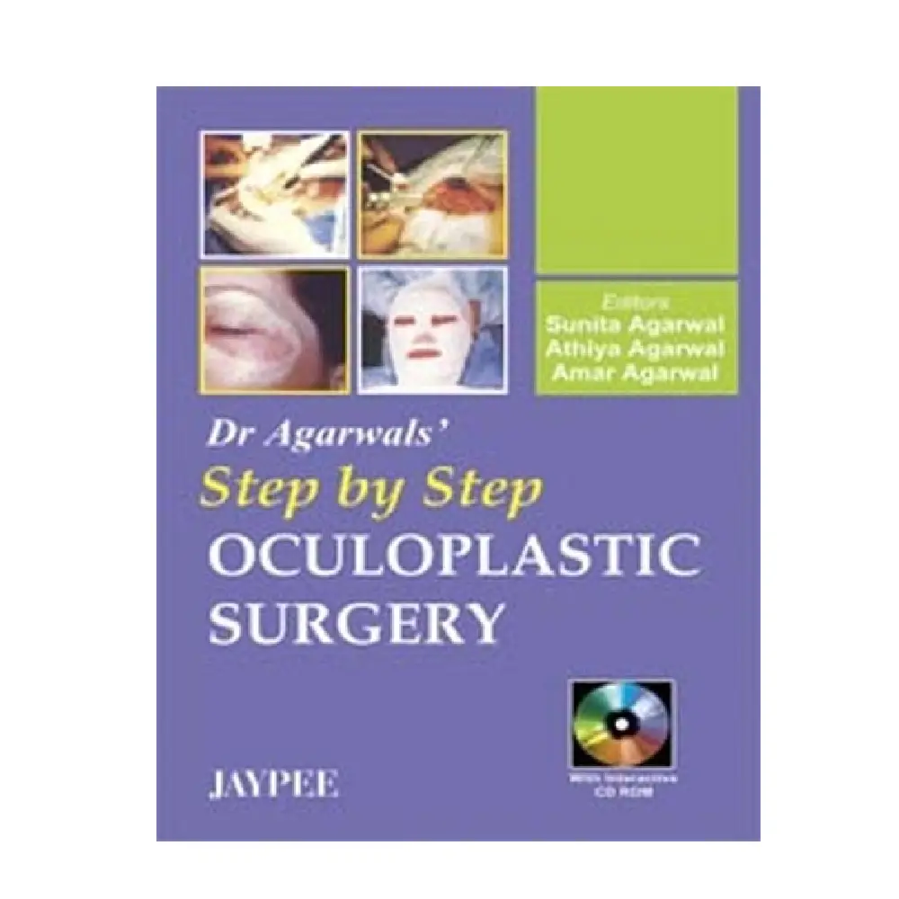 Dr. Agarwal's Step by Step Oculoplastic Surgery