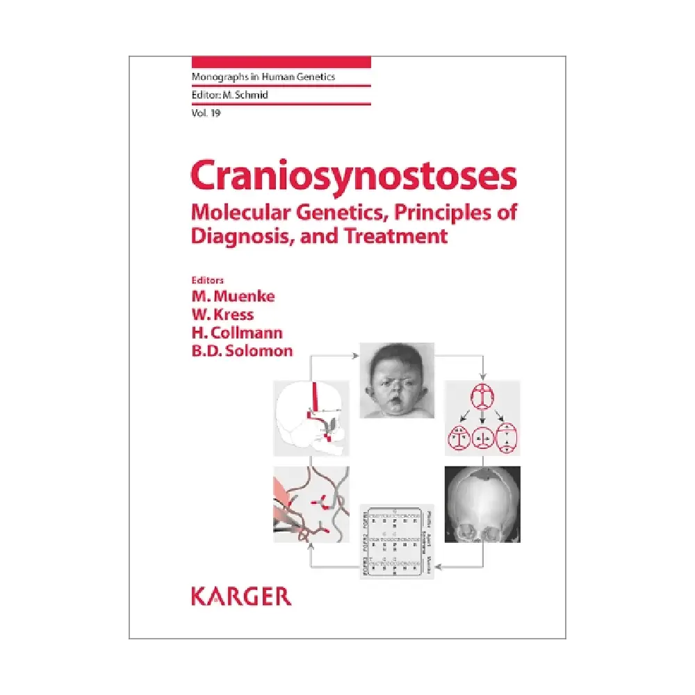 Craniosynostoses: Molecular Genetics, Principles of Diagnosis, and Treatment( volume-19 Monographs in Human Genetics)